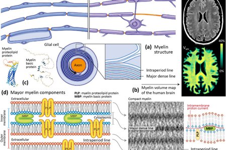 Сон как подзарядка: как миелиновая оболочка нервов сохраняет энергию для мозга